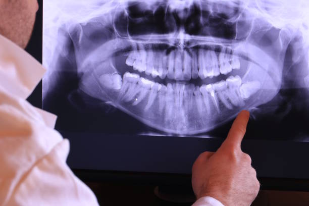Best Orthodontic Emergency Dentist in Montalvin Manor, CA