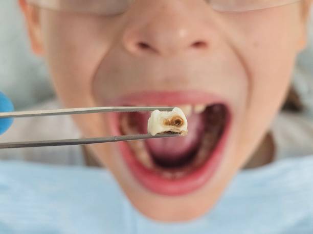 Best Urgent Dental Care for Toothache in Montalvin Manor, CA